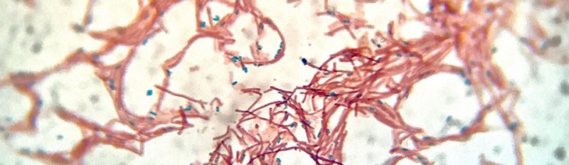 Bacillus subtilis, или сенная палочка